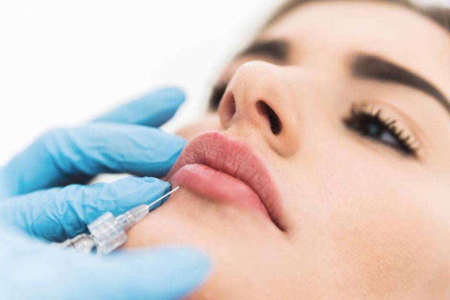 filler labbra